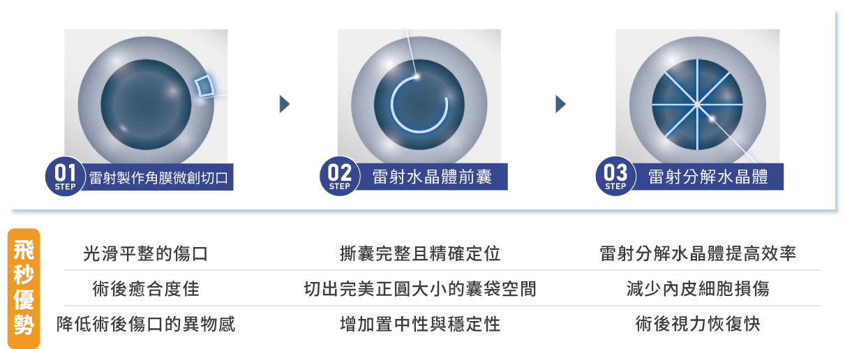 飛秒雷射白內障