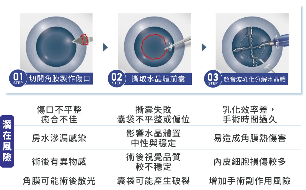 傳統白內障手術