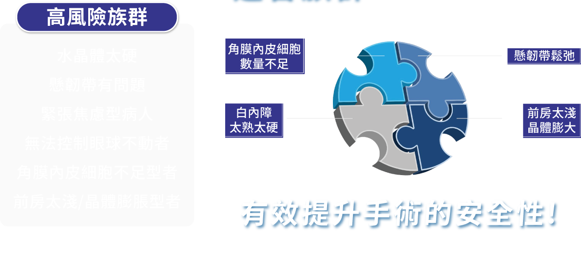 SMART飛秒雷射白內障適合族群